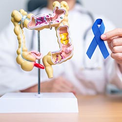 Colon Surgery for Colon Cancer Near Me in Phoenix, AZ