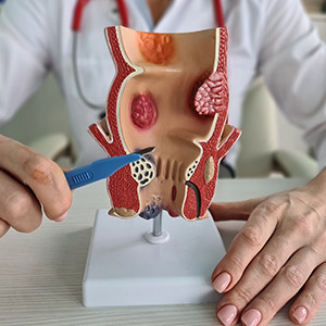 Colon and Rectal Surgery Near Me in Phoenix, AZ