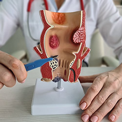 Colon and Rectal Surgery Near Me in Phoenix, AZ