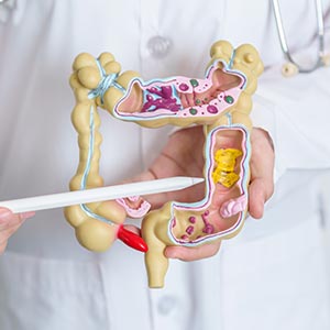 Colon Surgery for Diverticulitis Near Me in Phoenix, AZ