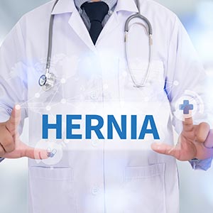 Hernia Repair Near Me in Phoenix, AZ