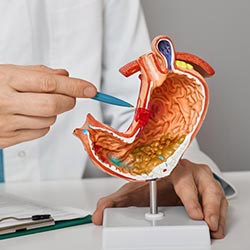 Ulcerative Colitis Surgery Near Me in Phoenix, AZ