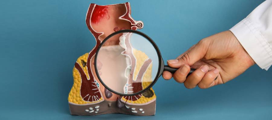 Colon Fistula Treatment in Phoenix AZ