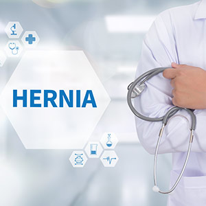 Giant Hernias in Phoenix, AZ