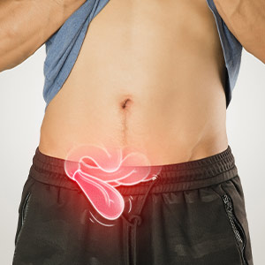 Incisional Hernia in Phoenix, AZ