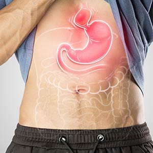 Incisionless Hiatal Hernia Repair in Phoenix, AZ