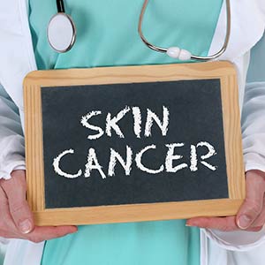 Skin Cancer in Phoenix, AZ