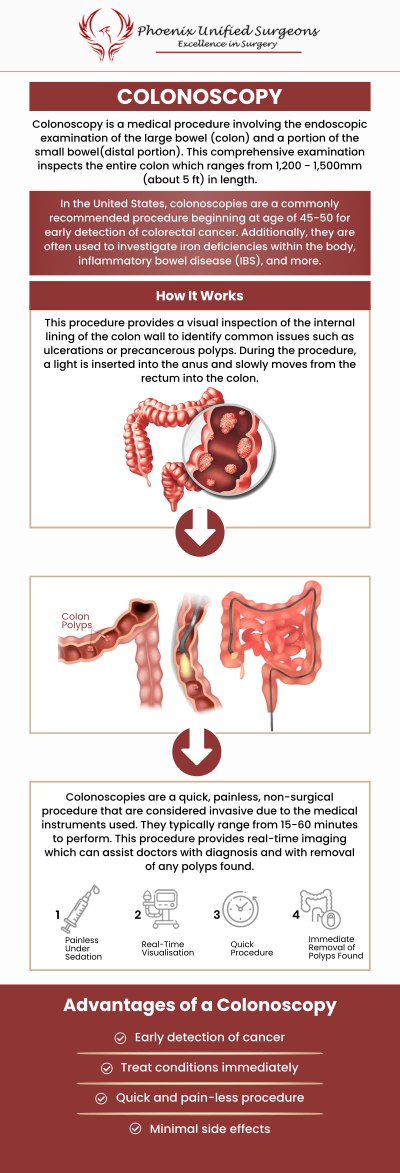 Colonoscopy is useful in the diagnosis of gastrointestinal disorders, including colon cancer and inflammatory bowel disease. Colon cancer can be prevented and treated with its assistance. Patients in and around Phoenix, AZ, may receive preventative and diagnostic colonoscopy treatments from Dr. Antonino Cammarata D.O., at Phoenix Unified Surgeons. We are conveniently located at 20333 N 19th Avenue, Ste 230 Phoenix, AZ 85027. For more information, contact us or request an appointment online.