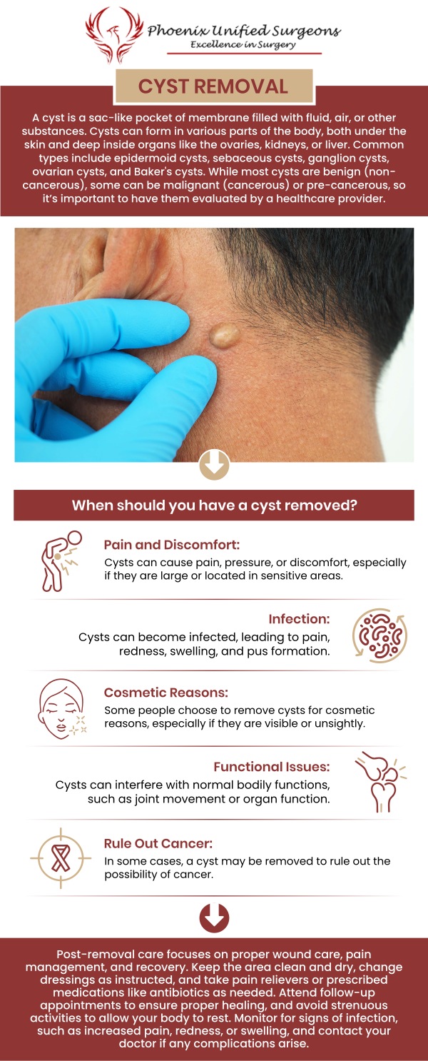 Cyst removal surgery is done to remove cysts causing discomfort, infection, or aesthetic issues. Costs vary based on the cyst's size, location, and procedure complexity, with additional expenses for anesthesia and post-surgery care. Typically ranging from $500 to $2,500 without insurance. Consult Dr. Antonino Cammarata, D.O., at Phoenix Unified Surgeons for assessing the cyst and developing a treatment plan, along with obtaining a tailored cost estimate. For more information, contact us or request an appointment online. We are conveniently located at 20333 N 19th Avenue, Ste 230 Phoenix, AZ 85027.