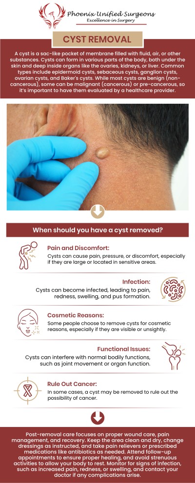 Cyst removal surgery is done to remove cysts causing discomfort, infection, or aesthetic issues. Costs vary based on the cyst's size, location, and procedure complexity, with additional expenses for anesthesia and post-surgery care. Typically ranging from $500 to $2,500 without insurance. Consult Dr. Antonino Cammarata, D.O., at Phoenix Unified Surgeons for assessing the cyst and developing a treatment plan, along with obtaining a tailored cost estimate. For more information, contact us or request an appointment online. We are conveniently located at 20333 N 19th Avenue, Ste 230 Phoenix, AZ 85027.