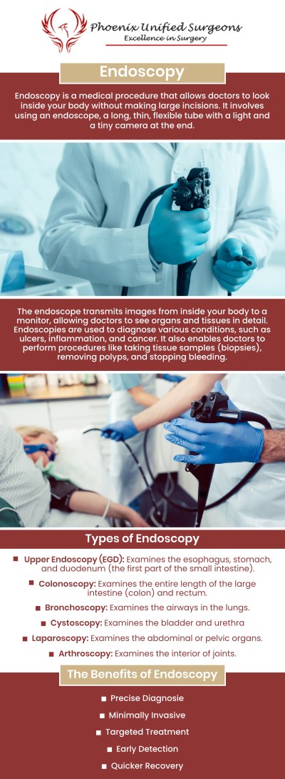 Endoscopy is a medical treatment that allows doctors to detect and treat various illnesses by looking into the digestive tract with a flexible tube equipped with a light and camera. It is frequently done as an outpatient procedure, is minimally invasive, and offers important insights into conditions including tumors, inflammation, and ulcers. For precise endoscopic diagnosis and efficient treatment of your digestive health issues, consult our knowledgeable staff at Phoenix Unified Surgeons. Please contact us or book your appointment online. Our office is conveniently located at 20333 N 19th Avenue, Ste 230 Phoenix, AZ 85027.