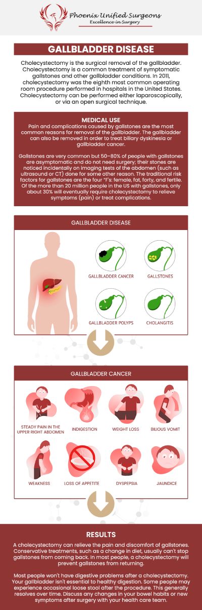 Gallbladder surgery is performed due to gallstones causing symptoms such as abdominal pain, nausea, vomiting, and jaundice. Other reasons for gallbladder surgery include inflammation of the gallbladder (cholecystitis), gallbladder polyps, biliary dyskinesia (impaired gallbladder function), and complications such as pancreatitis or cholangitis resulting from gallstones. See Dr. Debora J. Fox-McClary, M.D., MBA, FACS, FASCRS, Dr. Antonino Cammarata D.O., and Dr. J. Brian Brizendine, M.D., for gallbladder surgery to address persistent gallbladder problems and enhance your general quality of life. We are conveniently located at 20333 N 19th Avenue, Ste 230 Phoenix, AZ 85027. For more information, contact us or request an appointment online.