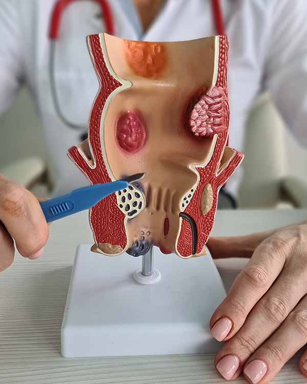 Colon and Rectal Surgery Near Me in Phoenix, AZ